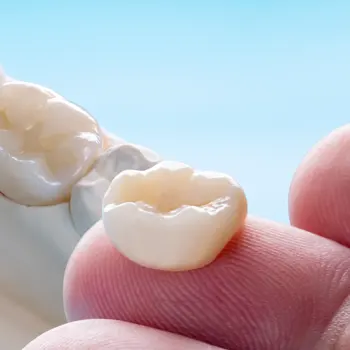 https://aurariadentalceramics.com/wp-content/uploads/2023/10/CAD-assist-temporary-crowns.webp