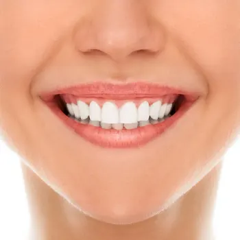 https://aurariadentalceramics.com/wp-content/uploads/2023/10/Trial-smile.webp