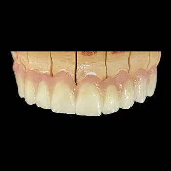 https://aurariadentalceramics.com/wp-content/uploads/2023/10/Zirconia.webp