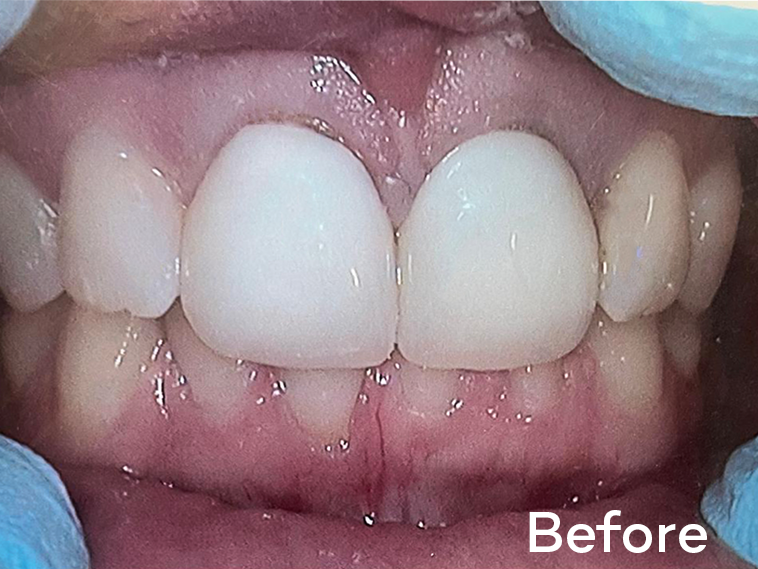 Custom-staining-1(1) Custom-staining-1(1)