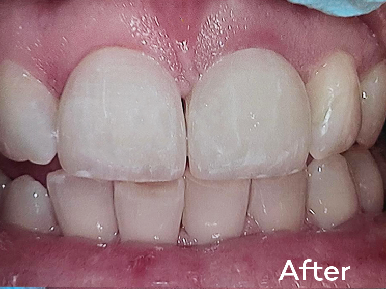 Custom-staining-2(1) Custom-staining-2(1)